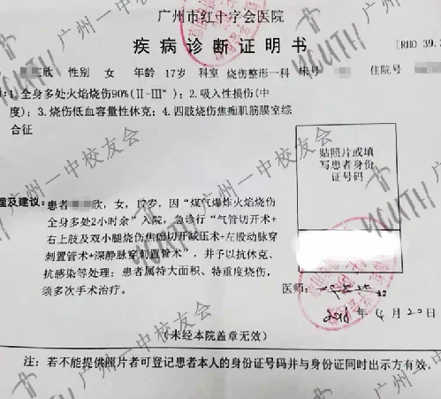 痛心!廣州17歲少女洗澡時煤氣爆炸 全身90%燒傷