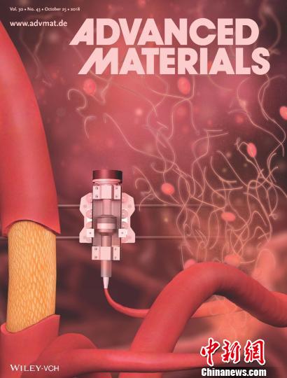 國際生物材料知名雜志封面。醫院供圖