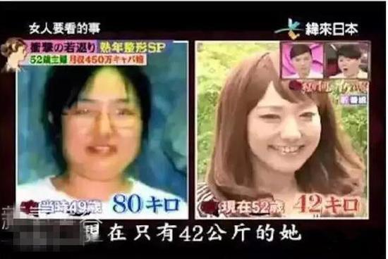 52歲大媽花450萬(wàn)整成少女 為做小姐動(dòng)刀20次(圖)